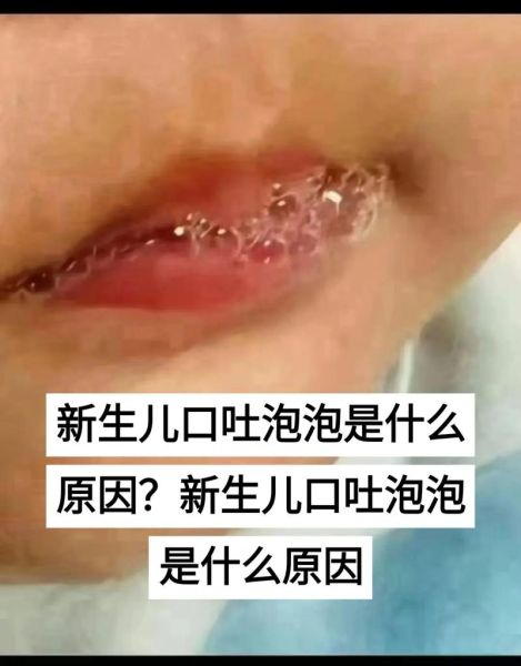 宝宝嘴巴吐泡泡怎么回事_新生儿吐泡泡正常吗