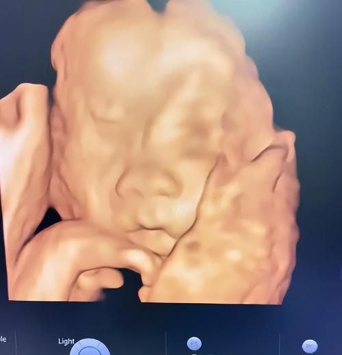 爸爸生宝宝_男人怀孕可能吗