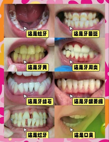 牙齿照片图片大全_如何辨别牙齿问题