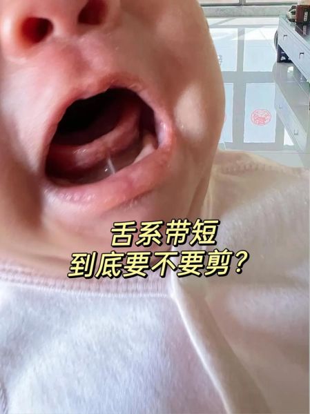 一岁五个月宝宝不会说话_正常吗