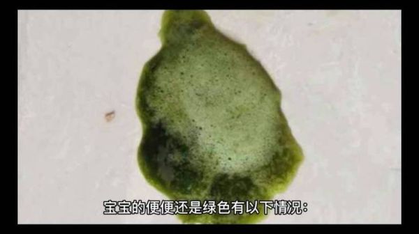 三个月宝宝拉绿色粑粑正常吗_绿色大便怎么办