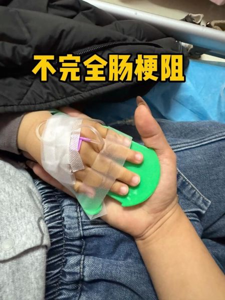 宝宝肠梗阻怎么治疗_新生儿肠梗阻能治好吗