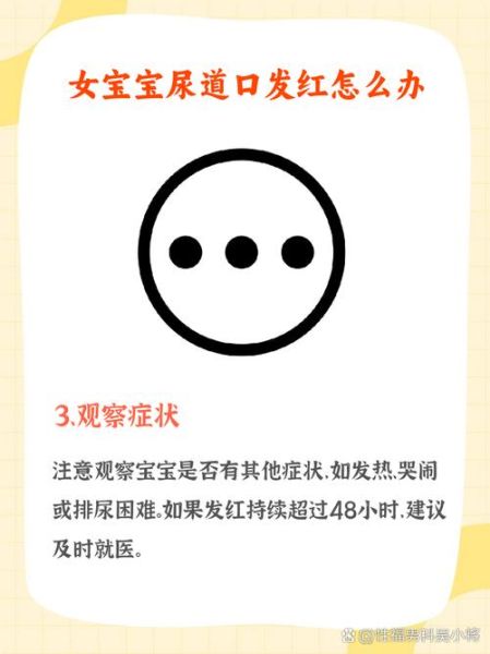 宝宝尿道口发红怎么办_宝宝尿道口红肿用什么药