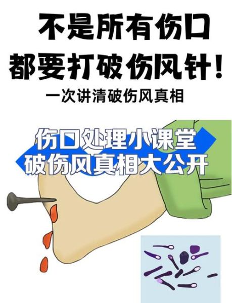 2岁宝宝打破伤风危害_需要打破伤风针吗