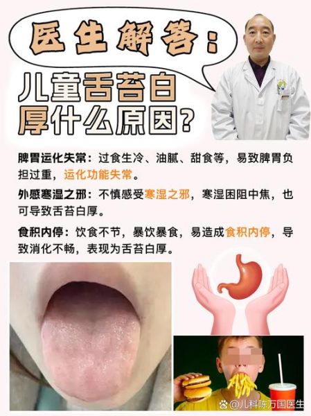 2岁宝宝舌苔厚白是怎么回事_舌苔厚白需要看医生吗