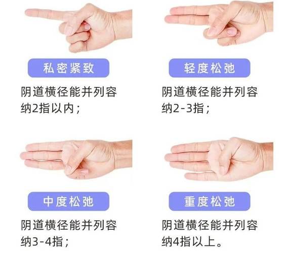 产后阴道松弛怎么办_产后松弛多久能恢复