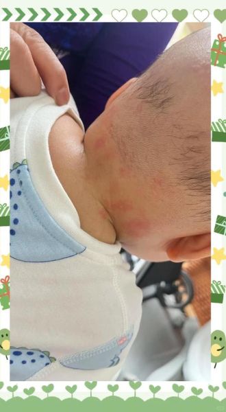 六个月宝宝不吃米粉怎么办_米粉过敏还是厌奶期