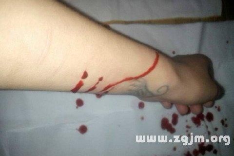 梦到自己手臂受伤流血_周公解梦