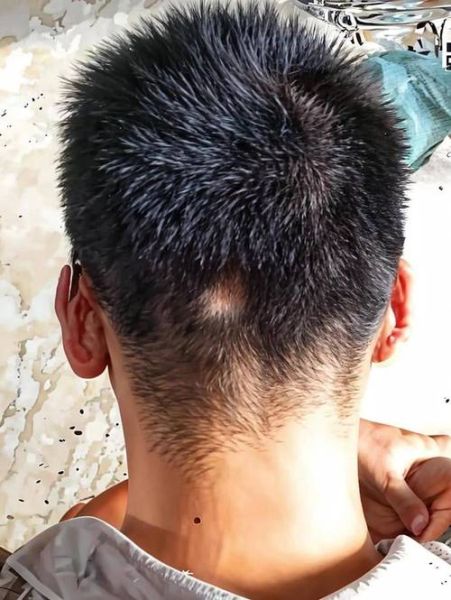 梦到光头是什么意思_梦见自己剃光头预示什么