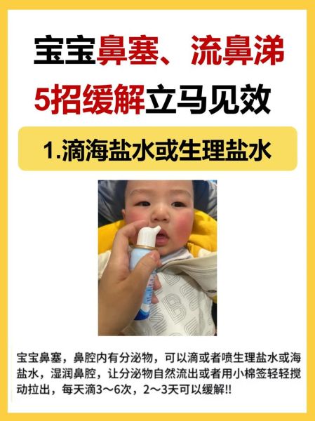 九个月宝宝流鼻涕怎么办_婴儿感冒鼻塞护理