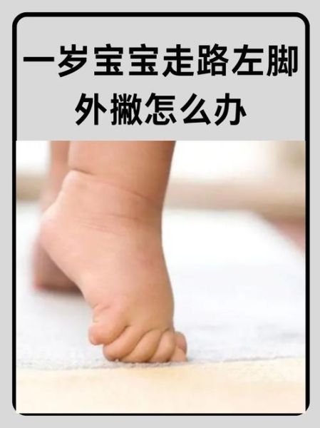 一岁半宝宝走路老是跑怎么办_宝宝走路爱跑正常吗