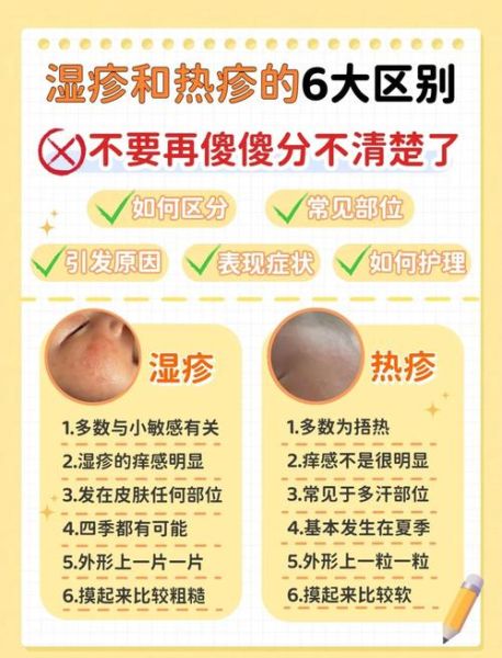 宝宝热疹用什么药膏_热疹和湿疹区别