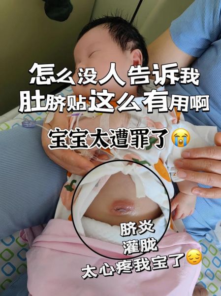 宝宝肚脐眼发红怎么办_新生儿肚脐护理方法