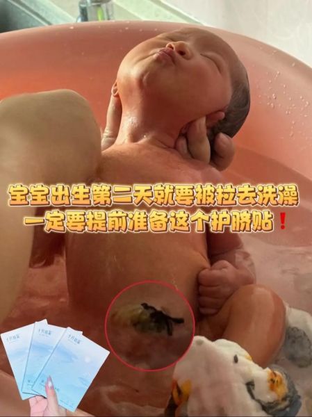 宝宝肚脐眼发红怎么办_新生儿肚脐护理方法