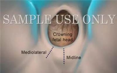 生宝宝视频全过程_顺产和剖腹产哪个疼