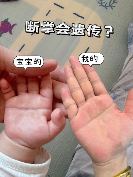 女宝宝双手断掌好不好_断掌女孩命运解析