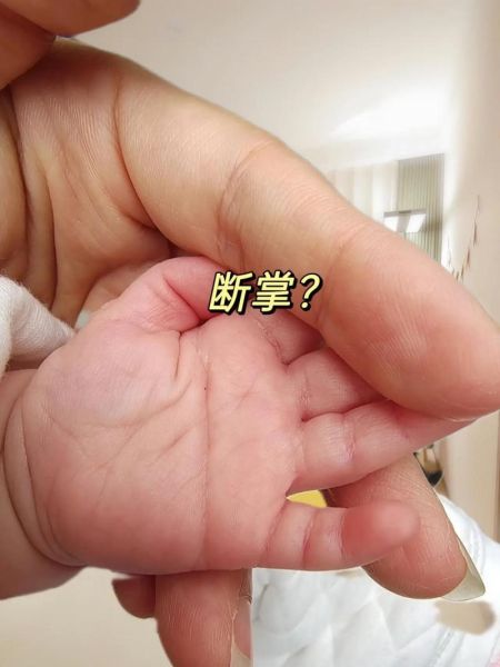 女宝宝双手断掌好不好_断掌女孩命运解析