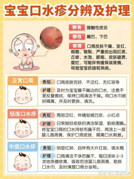 宝宝嘴上湿疹怎么办_宝宝嘴上湿疹小妙招