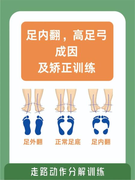 宝宝右脚内翻怎么办_矫正方法有哪些