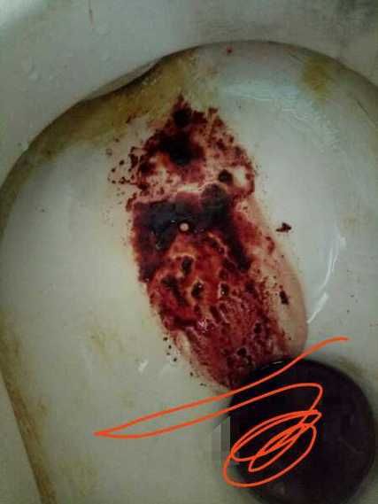 梦到例假血是什么意思_梦见月经血好不好