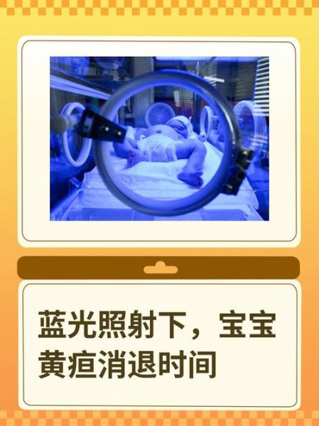 宝宝黄疸20怎么办_黄疸值20需要照蓝光吗