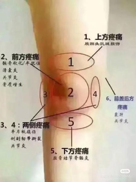 膝盖疼痛部位图解_膝盖结构图片大全