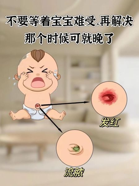 宝宝肚脐化脓怎么办_新生儿脐部护理方法