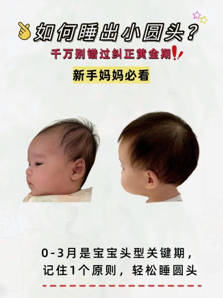 女宝宝什么头型好看_怎么睡出漂亮头型