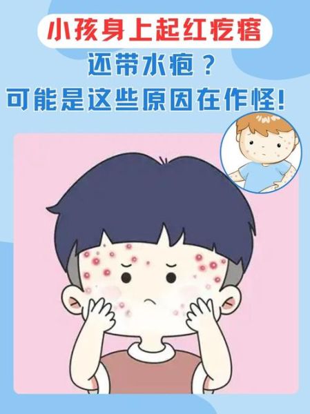 宝宝身上长小水泡怎么办_宝宝长水泡会传染吗