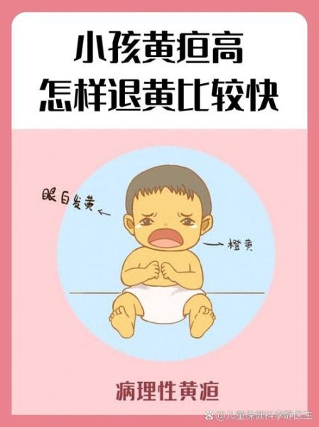 宝宝黄疸高是什么原因_新生儿黄疸多久能退