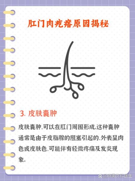 宝宝肛门息肉早期图片_肛门息肉会自愈吗