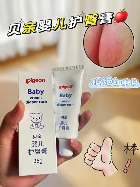 宝宝红屁屁怎么办_红屁屁用什么药膏最有效