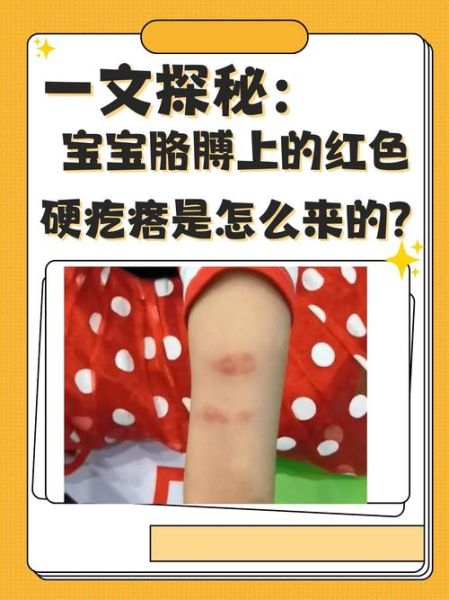 七个月宝宝起红疙瘩图_宝宝红疙瘩怎么办
