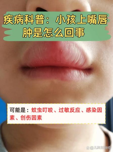 宝宝嘴唇红红的怎么回事_宝宝嘴唇红是上火吗