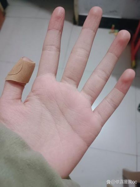 梦见手流血是什么意思_如何化解噩梦带来的焦虑