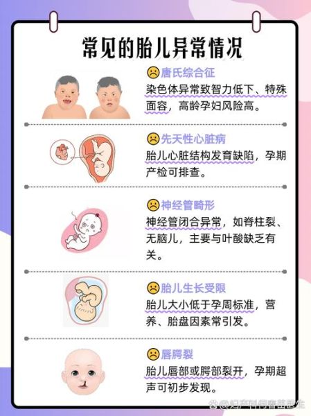 唐宝宝是什么意思_唐氏综合征儿童特征