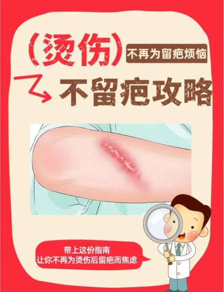 烫伤图片大全_烫伤后怎么处理不留疤