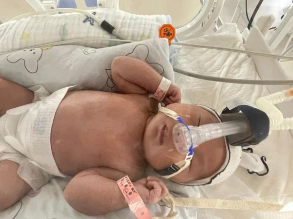 宝宝在新生儿科受罪吗_新生儿科住院真实体验