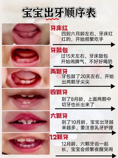 宝宝牙齿多久长齐_乳牙全部萌出时间表