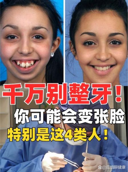 美牙图片大全_美牙前后对比真实案例