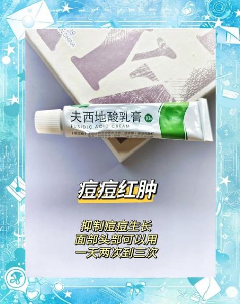 两岁宝宝脸上长癣怎么办_用什么药膏安全