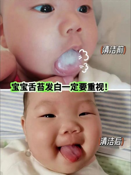 两个月宝宝舌苔白怎么办_两个月宝宝舌苔白正常吗