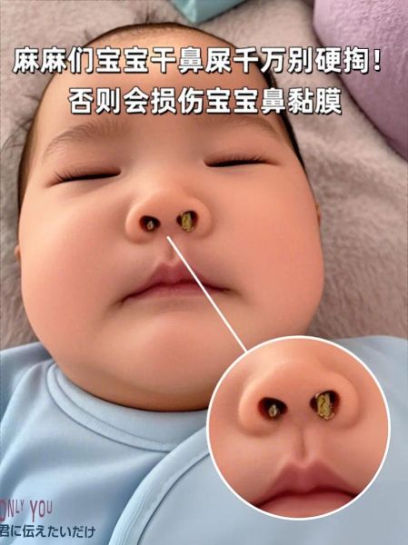 宝宝总是抠鼻子怎么办_宝宝抠鼻子会不会抠坏