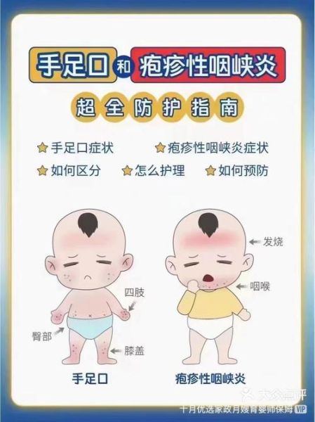 宝宝手足口病怎么护理_手足口病几天能好