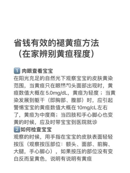 70天黄疸还没退正常吗_母乳性黄疸最晚多久退