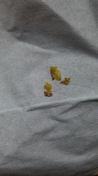 梦到耳朵里掏出好多耳屎_是什么预兆