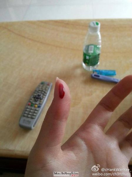 梦到手破了是什么意思_梦见手破皮了代表什么