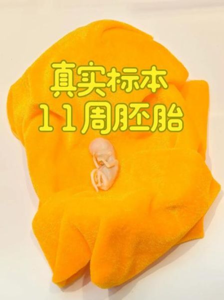 11周胎儿大小_怀孕11周宝宝发育图怎么看