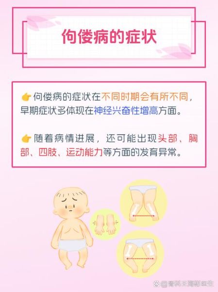 宝宝佝偻病早期症状有哪些_佝偻病怎么治疗最好