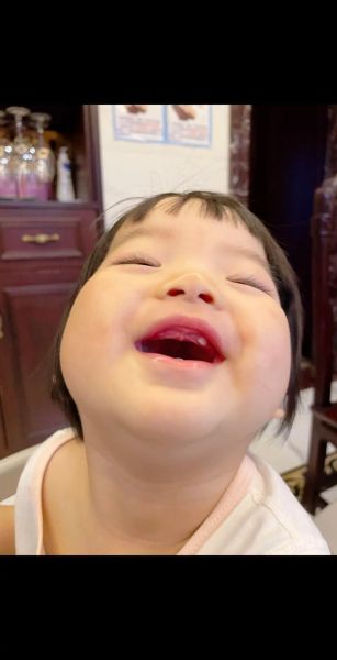 宝宝长虎牙怎么办_虎牙会不会自己掉